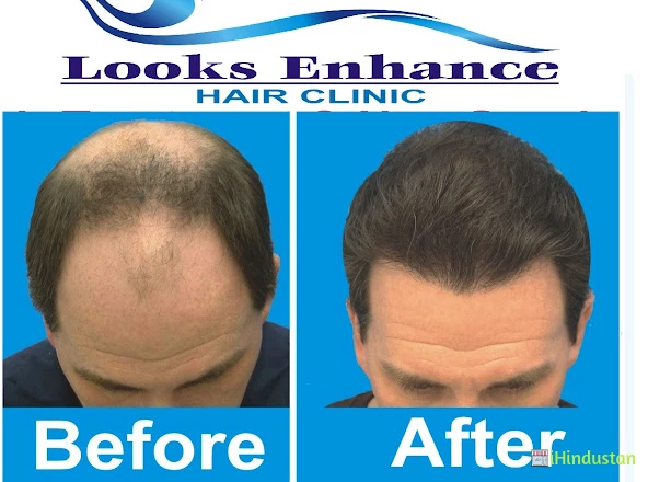 Looks Enhance - Logo