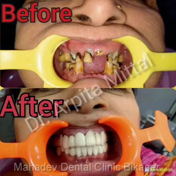 Mahadev Dental Clinic Gangasahar Bikaner - Cover photo