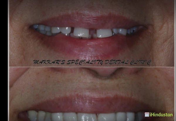Makkar's Speciality Dental Clinic - Logo