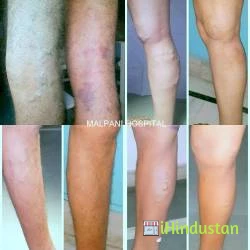 Malpani Multispeciality Hospital & Vericose Vein Laser - Logo