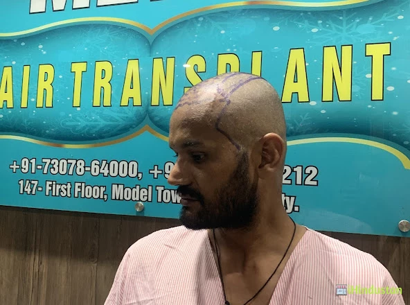 Metro Hair Transplant Centre - Logo