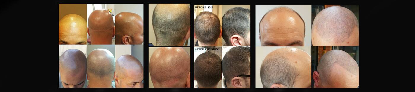 Micropigmentation Aesthetics Studio - Cover photo