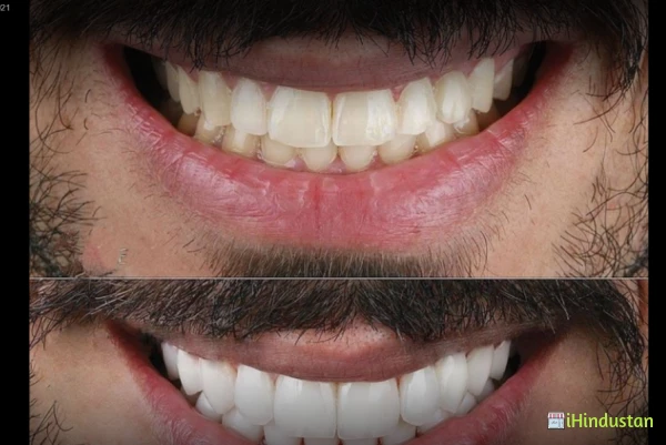 Mithilanchal Dental Care - Logo