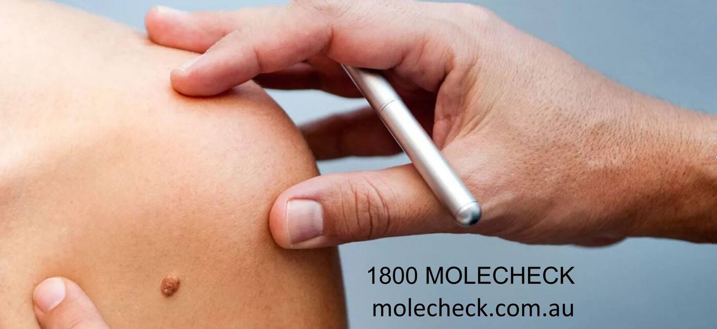 Mole Check Clinic - Cover photo