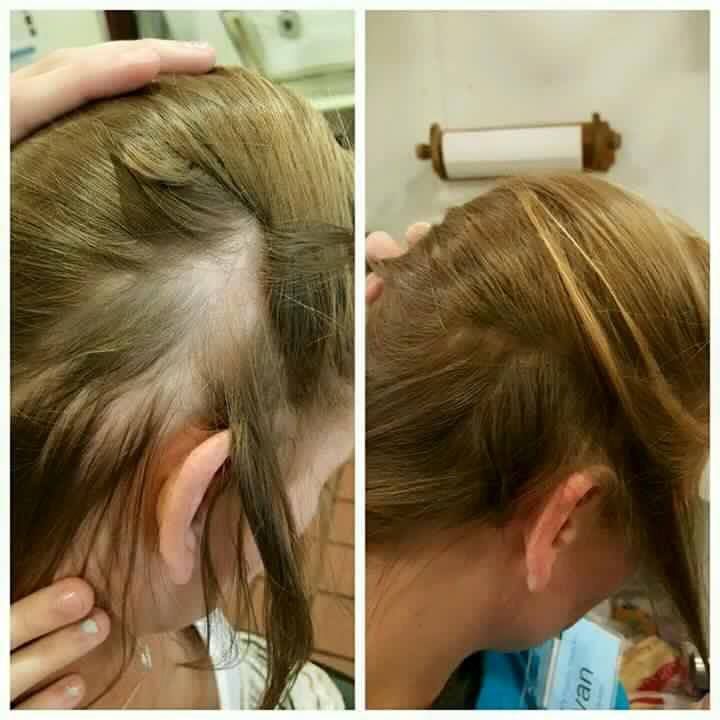 MONAT Hair Care to Reverse Hair Loss &a; Repair Damage - Logo