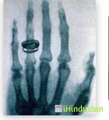 Mona X-Ray - Logo