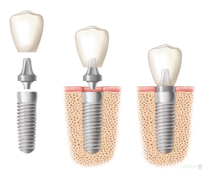 My Dental Care - Cover photo