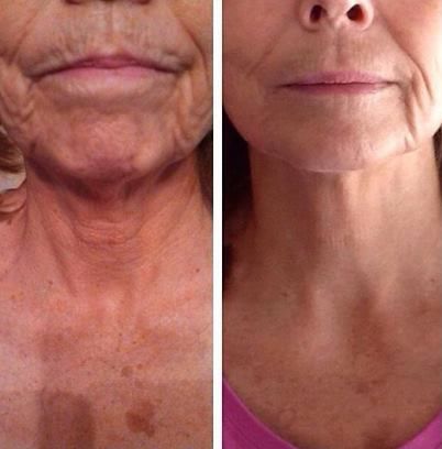 Nerium Brand Partner Laurie Sowman - Cover photo