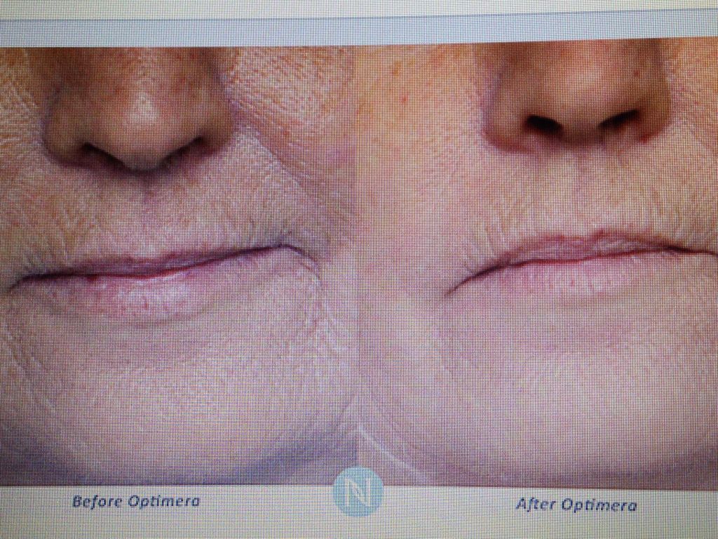Nerium International Brand Partner - Sue Ann - Cover photo