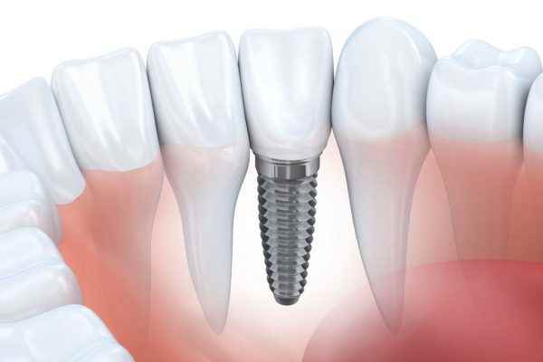 Noor Dental Clinic - Cover photo