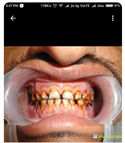 Parth Dental Clinic - Logo