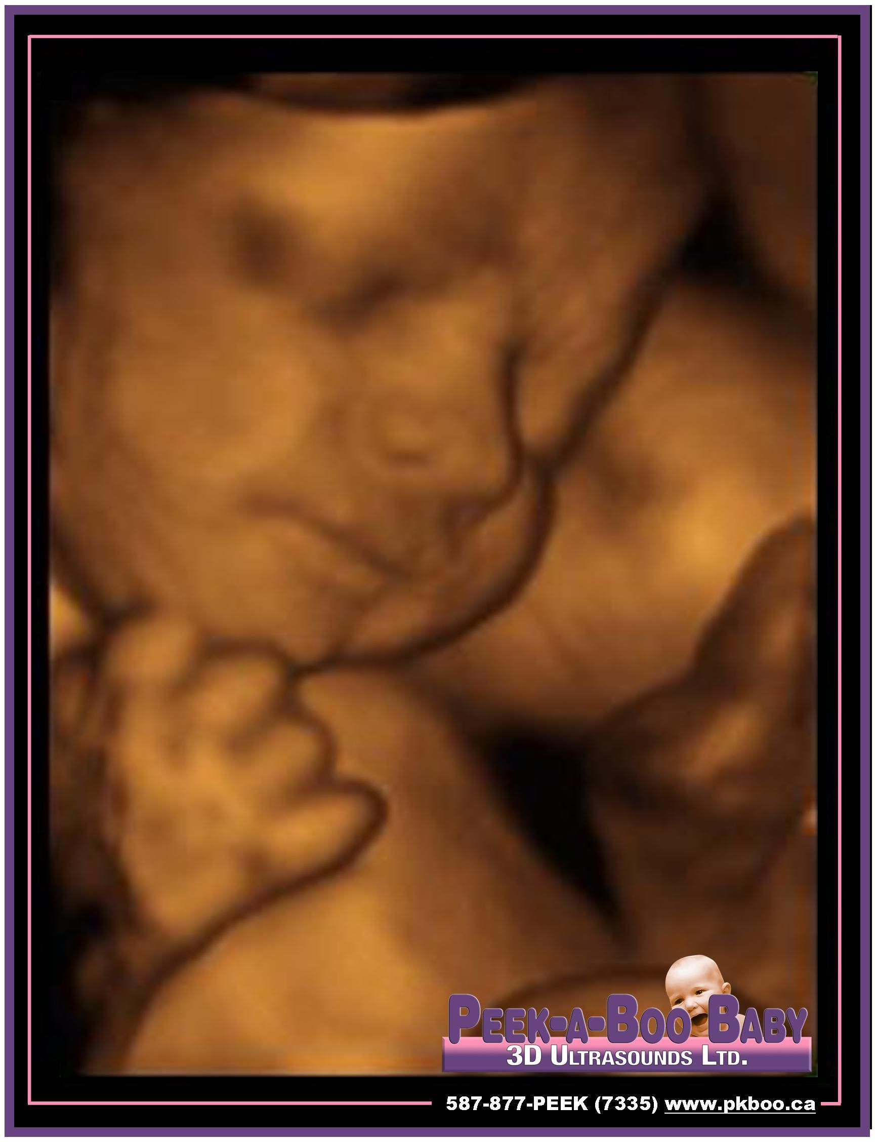 Peek-a-Boo Baby 3D Ultrasounds Ltd. - Cover photo