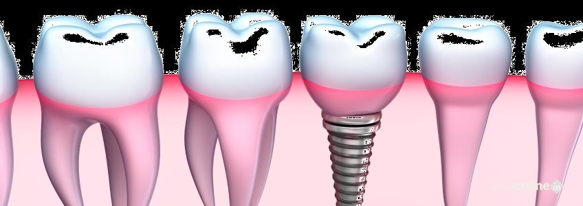 Perfect32 Dental Care - Cover photo