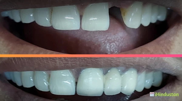 Perfect Dental Clinic - Logo