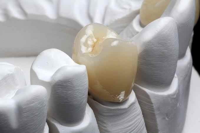 Perfect Dental Hospital - Cover photo