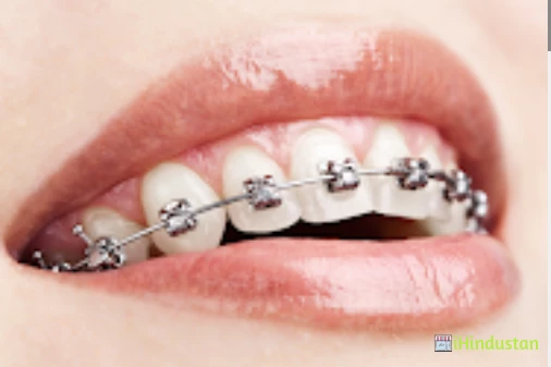 Perfect Smile - Logo