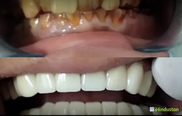 Perfect Smile Dental care &Implant Centre - Logo