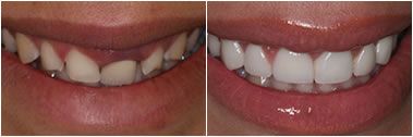 Permasmile Dentistry at Slater - Cover photo