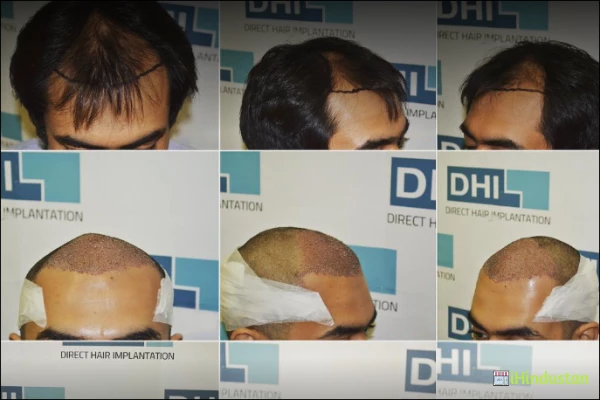 Premium & Trusted Hair Transplant - Logo