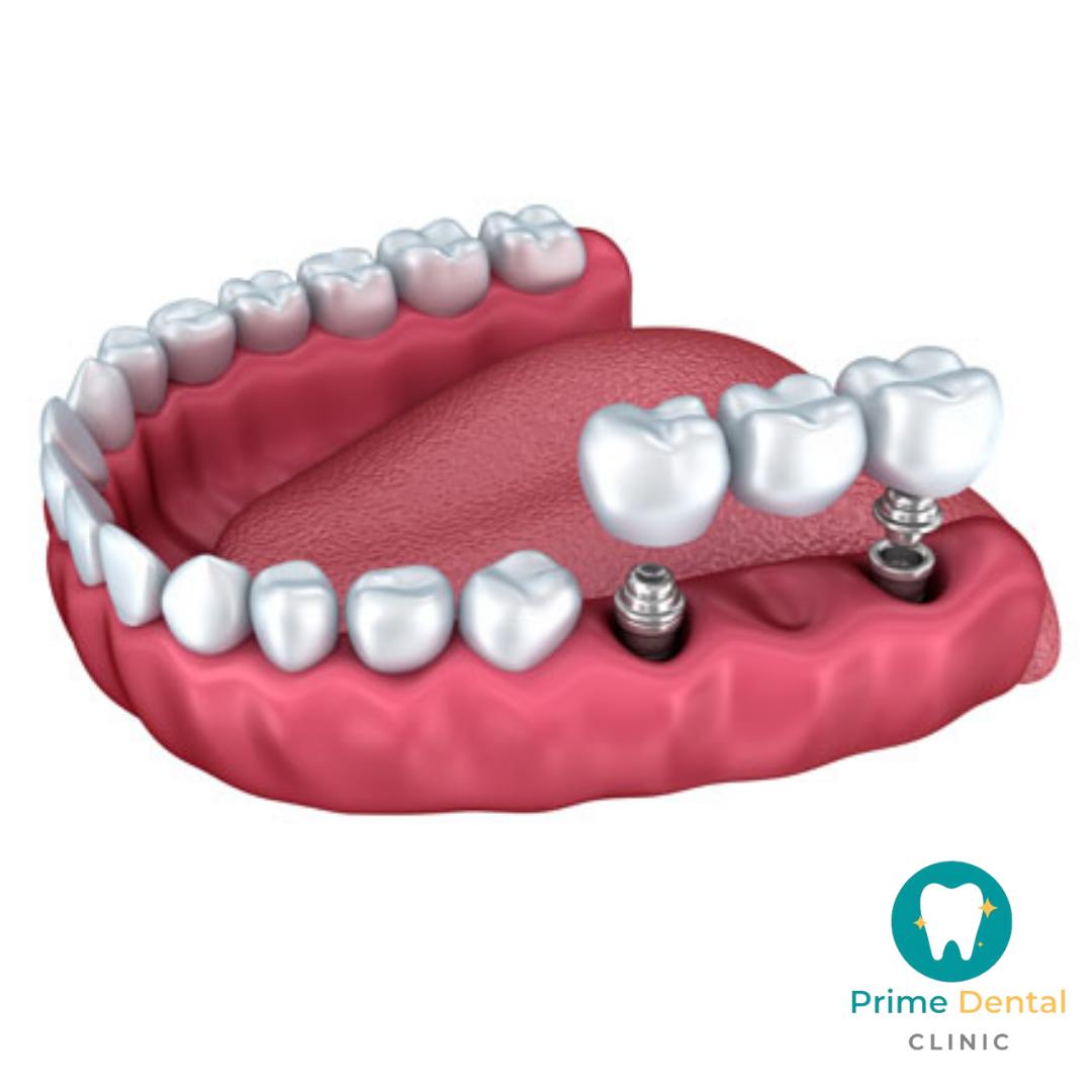 Prime Dental Clinic - Cover photo