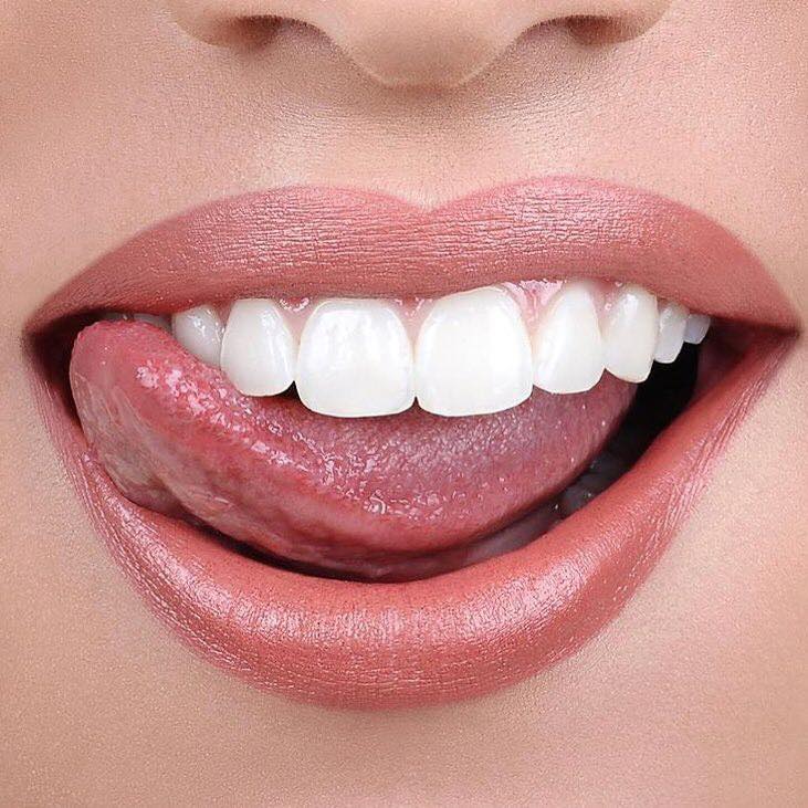 PureSmile Teeth Whitening Canberra - Cover photo