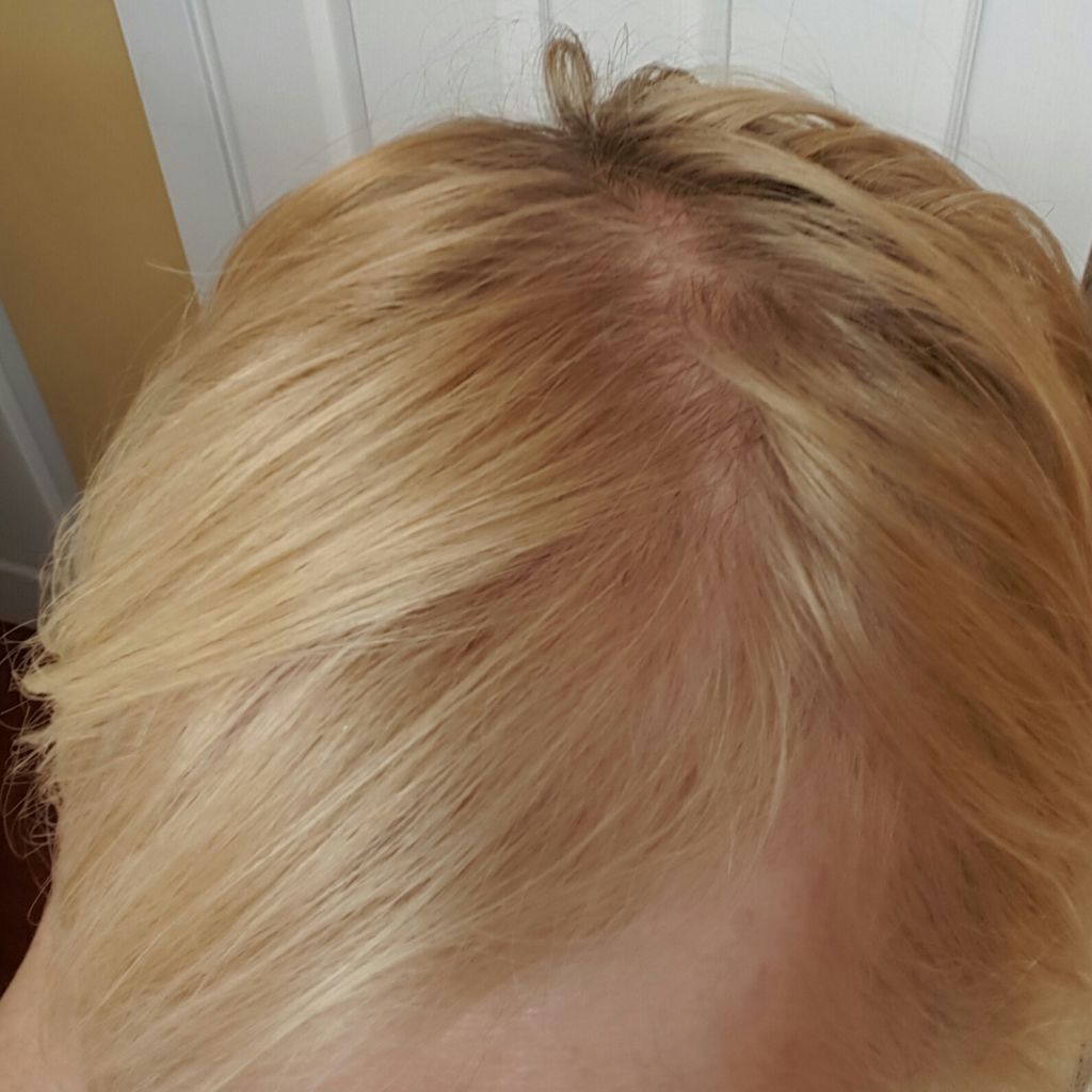 Real Hair Loss Solution - Logo