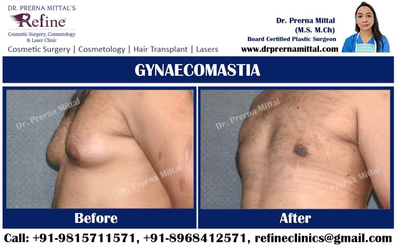 Refine Aesthetic Clinic Punjab - Cover photo