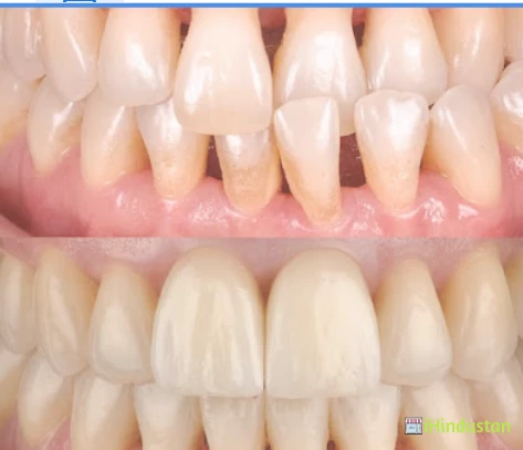 Reflections Dental and implant Centre - Logo
