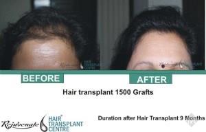 Rejuvenate Hair Transplant Centre - Cover photo