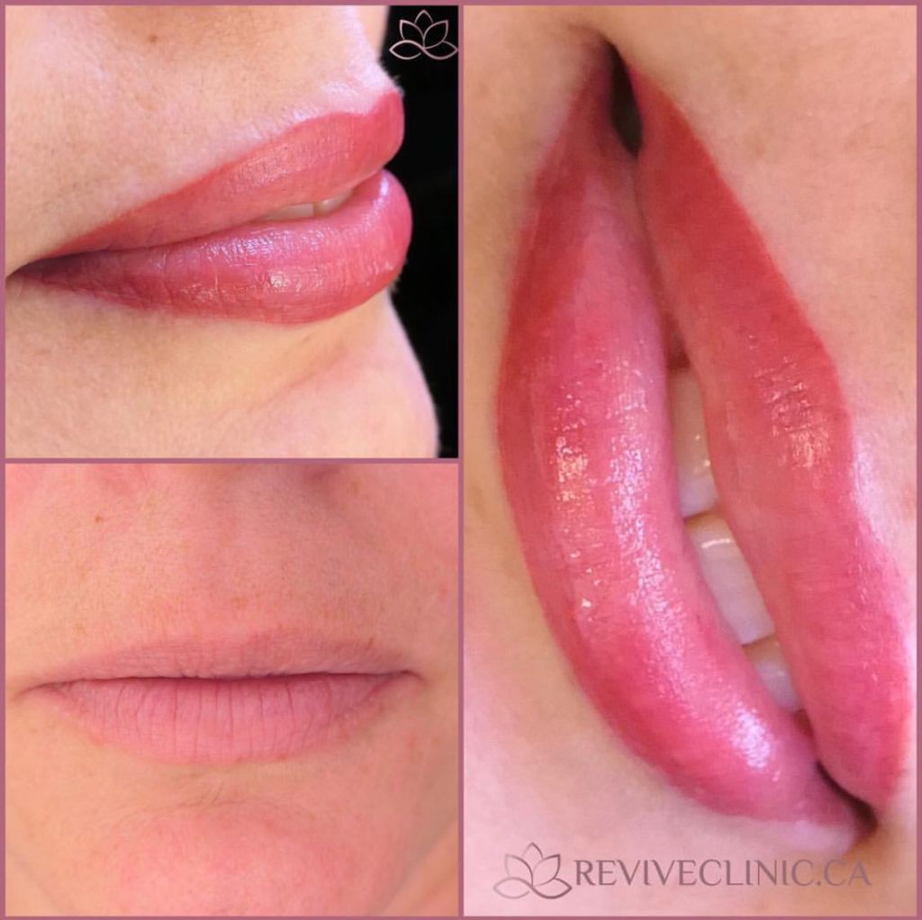 Revive Clinic Cosmetic Tattooing - Cover photo
