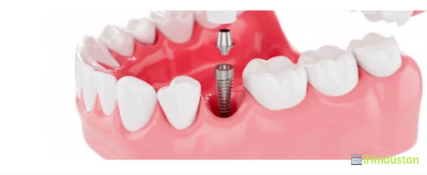 Sachdeva dental clinic - Logo