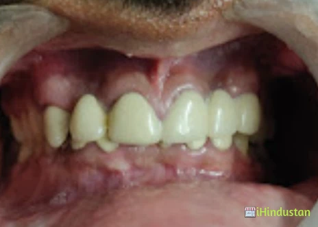 SAI DENTAL CARE DR.ANURAG PATEL B.D.S - Logo