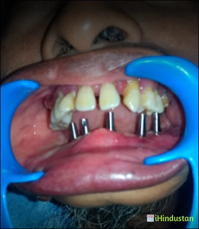 Sai Diamond Dental Clinc - Logo