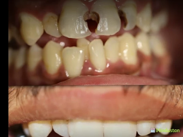 Santosh Dental Care - Logo