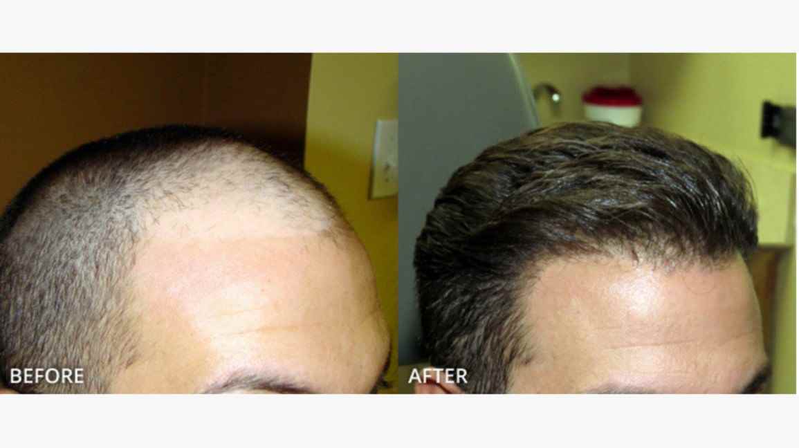 Satyam Hair Transplant Ambala 280485 - Cover photo