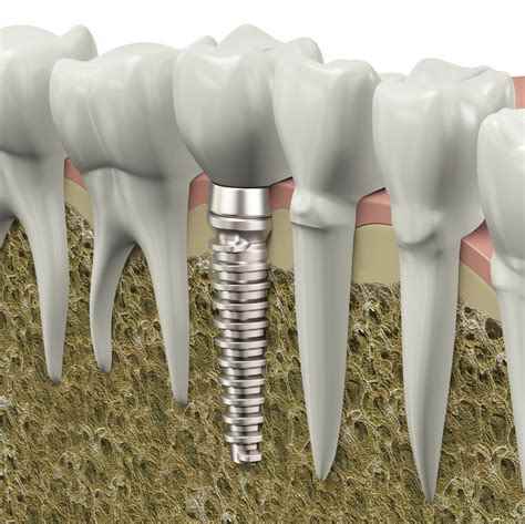Sendhil Dental Clinic - Cover photo