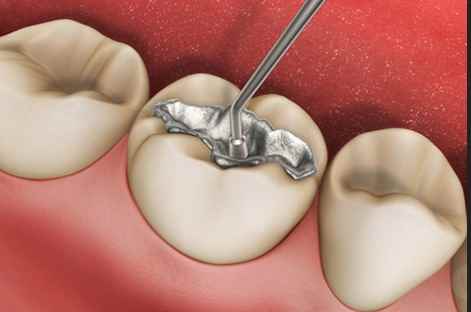 Sharanya Dental Clinic - Cover photo