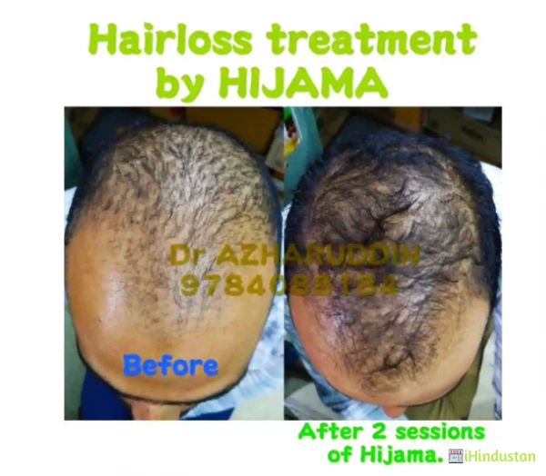 Shifa Unani Clinic & Hijama Center - Logo