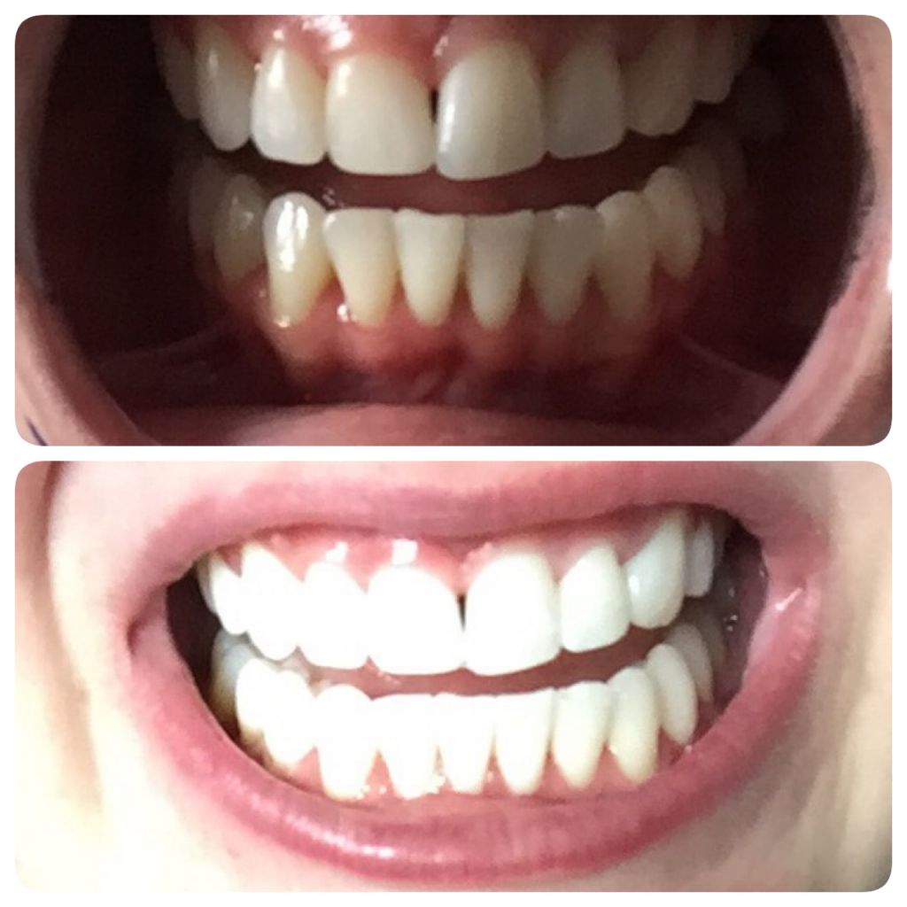 Shimmer Teeth Whitening Studio - Cover photo