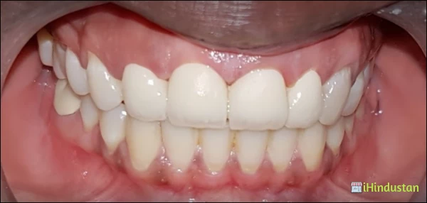 Shine Dental Care - Logo