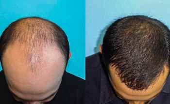 Shine Hair Studio For Men And Women - Cover photo