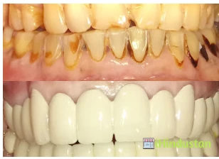 Shirdi Vinayak Dental Care - Logo