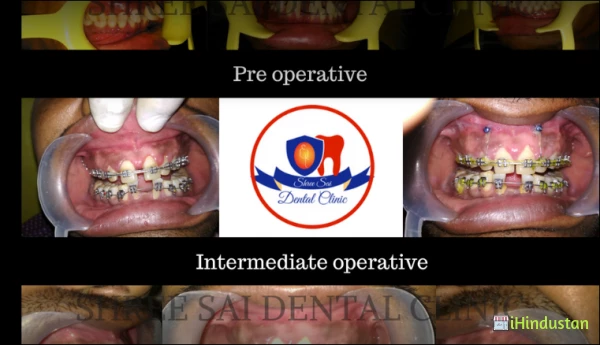 Shree Sai Dental Clinic - Logo