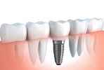 Singh Dental Care - Cover photo