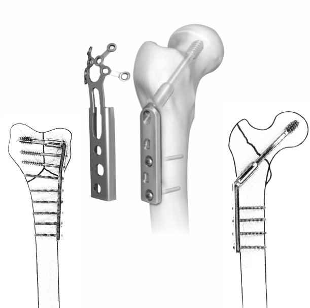 Siora Surgicals Private Limited - Cover photo