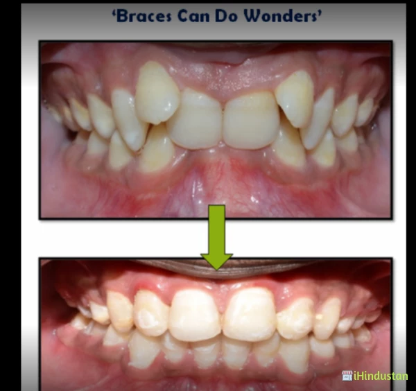 Smile+ Dental clinic Advanced Implant - Logo