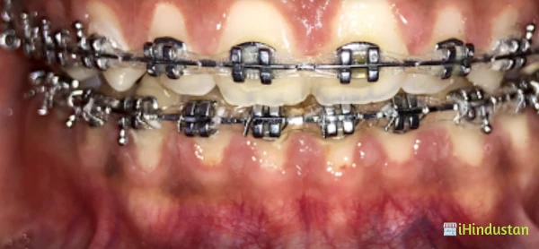 Smile Dental Solutions - Logo
