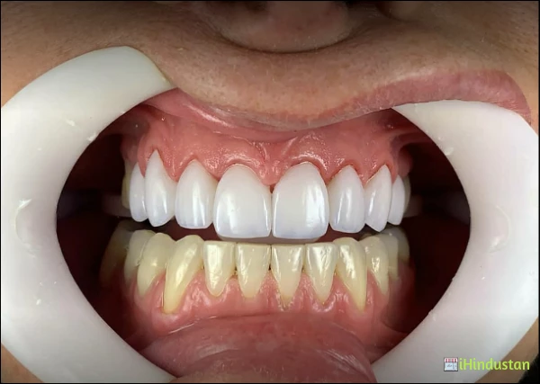 Smile Line Dental Clinic - Logo