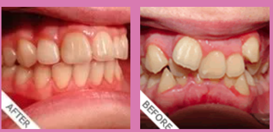 Smiling Wide Orthodontics - Logo