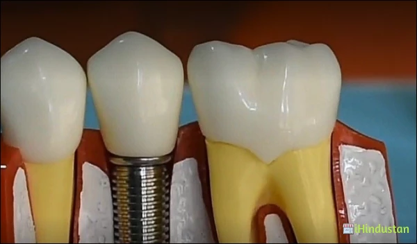 Sree Lalitha Dentistry - Logo
